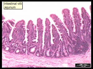 intestine