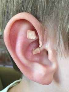 Ear Seeds on Ear.jpg