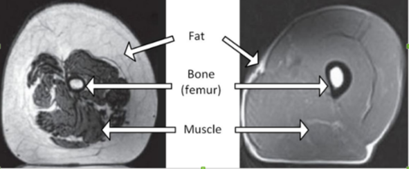 muscle-cross-section.png