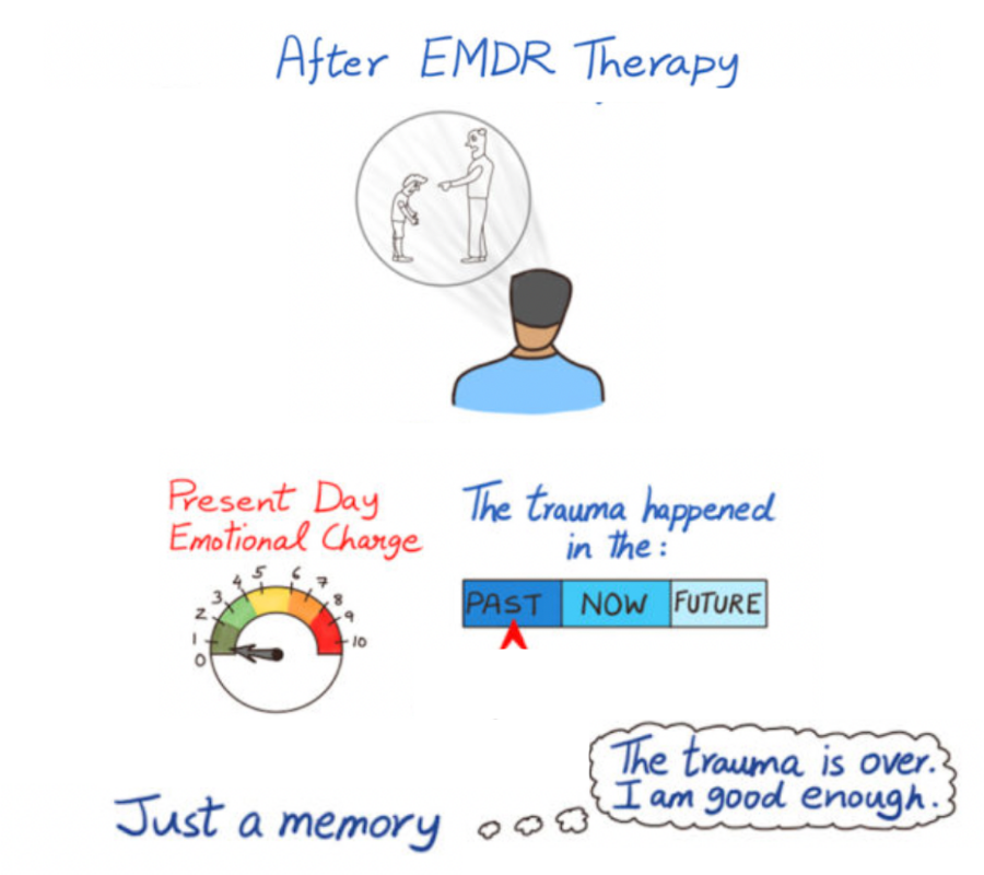 after emdr